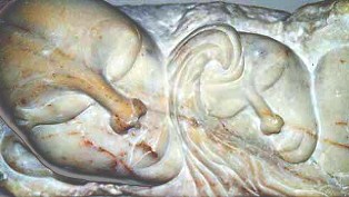 agillascura.jpg agillascura.jpg